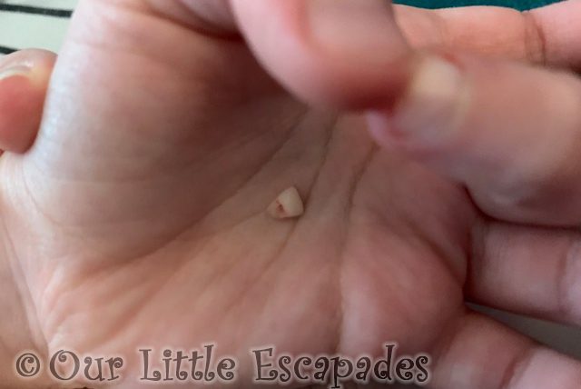 baby tooth little es hand