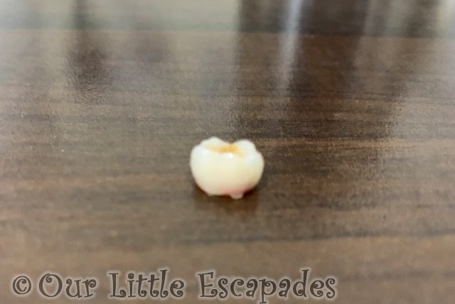 ethans lost tooth 2021 Week 16